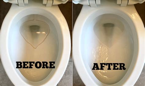Will toilet stains go away?