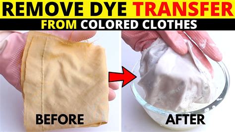 Will white vinegar remove dye stains?