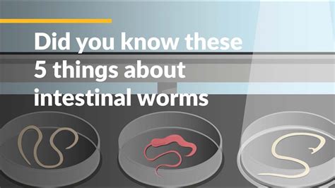 Would I know if I had intestinal worms?